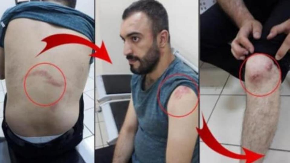 Terziyle tartışan polis, ‘cumhurbaşkanına hakaret etti’ diye dayakla gözaltına aldırdı