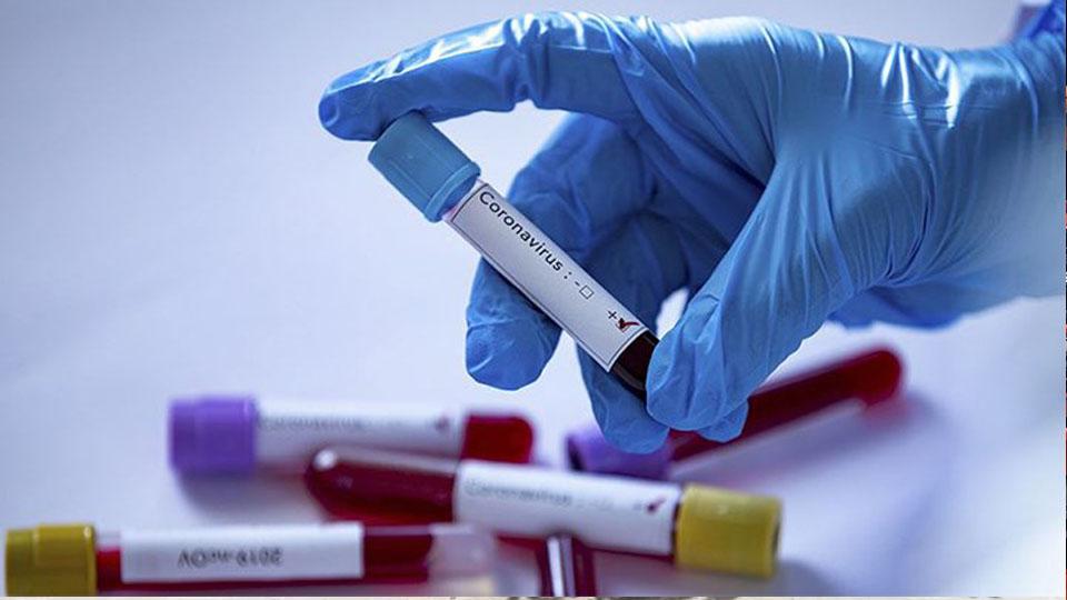 Koronavirüs Güncesi: Dünya geneli vaka sayısı 9 milyona yaklaştı