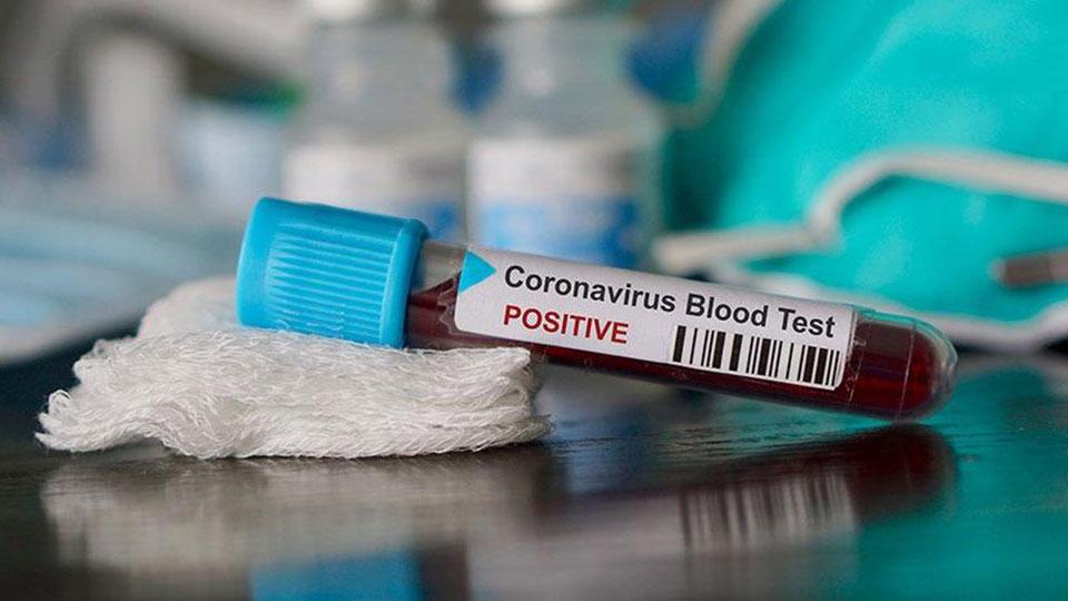 Koronavirüs Güncesi: 14 milyon 707 bin 451 vaka