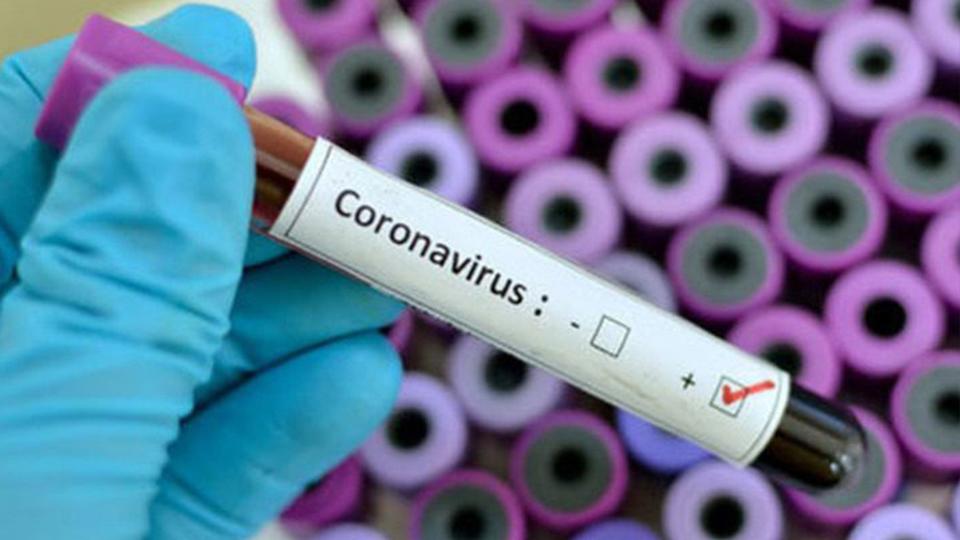 Serhatın Sesi / Serhat Diyarından Haberler / Koronavirüs Güncesi: Vaka sayısı 13 milyon 70 bin 97’ye yükseldi