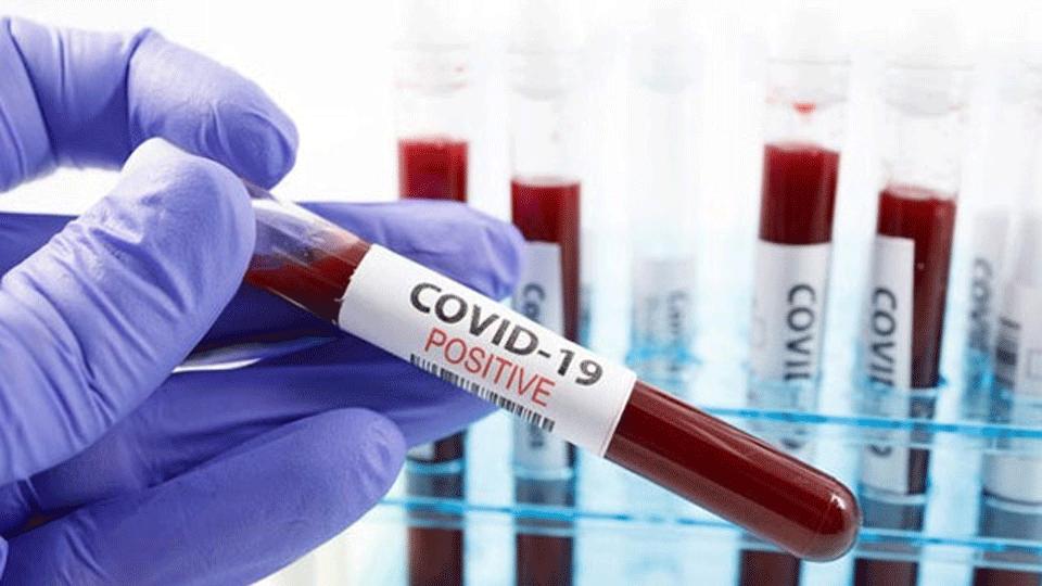 Koronavirüs Güncesi: Vaka sayısı 16 milyonu aştı