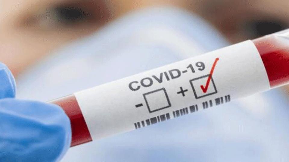 Koronavirüs Güncesi: Vaka sayısı 17 milyonu 859 bin 763’e ulaştı